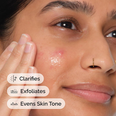 Ordinary Salicylic Acid 2% Solution 30ml - view 2