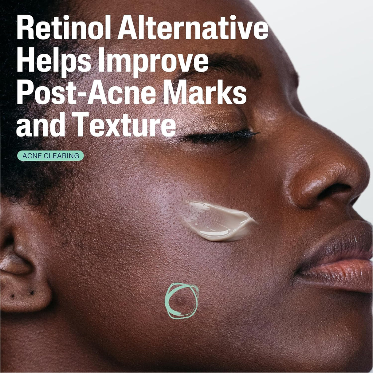 Cetaphil Post-Acne Retinol Alternative Serum