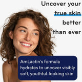 AmLactin Intensive Healing Body Cream, 12 oz Tub, 2-in-1 Exfoliator and Moisturizer - Kenya