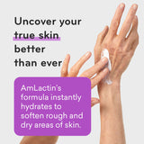 AmLactin Ultra Smoothing - 4.9 oz - Kenya