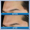 CeraVe Acne Foaming Cream Wash 10% Benzoyl Peroxide image 4