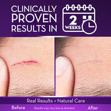 Cicatricure Advanced Scar Gel for Face & Body - price in Kenya
