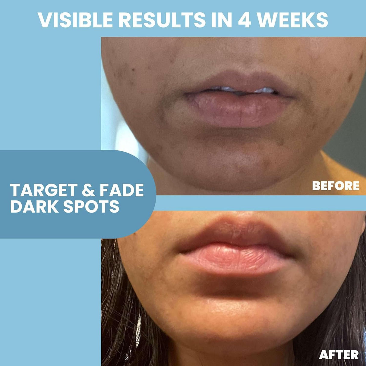 Eva Naturals Niacinamide Serum - price in Kenya