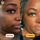 GLO Melanin Turmeric Scrub for Dark Spots Brightening - Kenya
