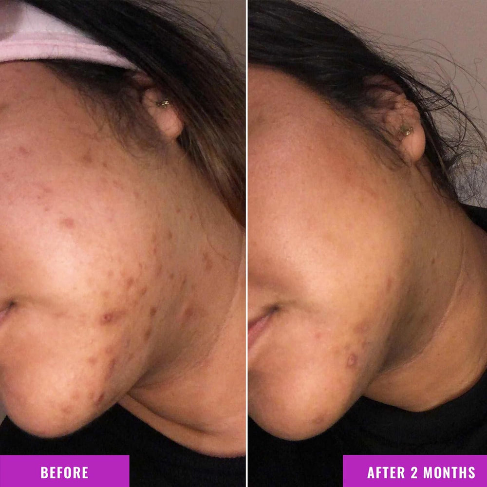 Good Molecules Discoloration Correcting Serum - Kenya