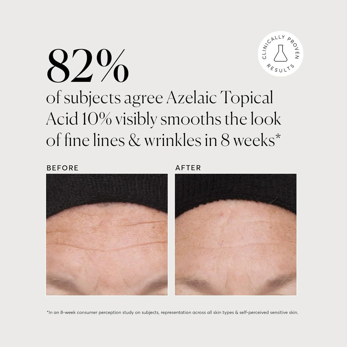 Naturium Azelaic Topical Acid 10% - Kenya