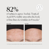 Naturium Azelaic Topical Acid 10% - Kenya
