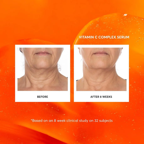 Naturium Vitamin C Complex Face Serum - Kenya