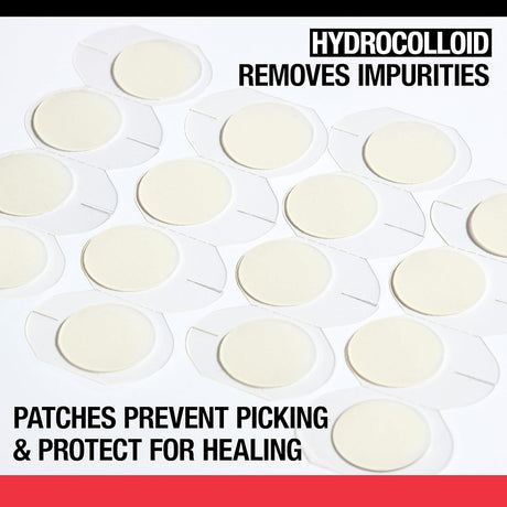 Neutrogena Stubborn Acne Pimple Patches- Kenya - Kenya