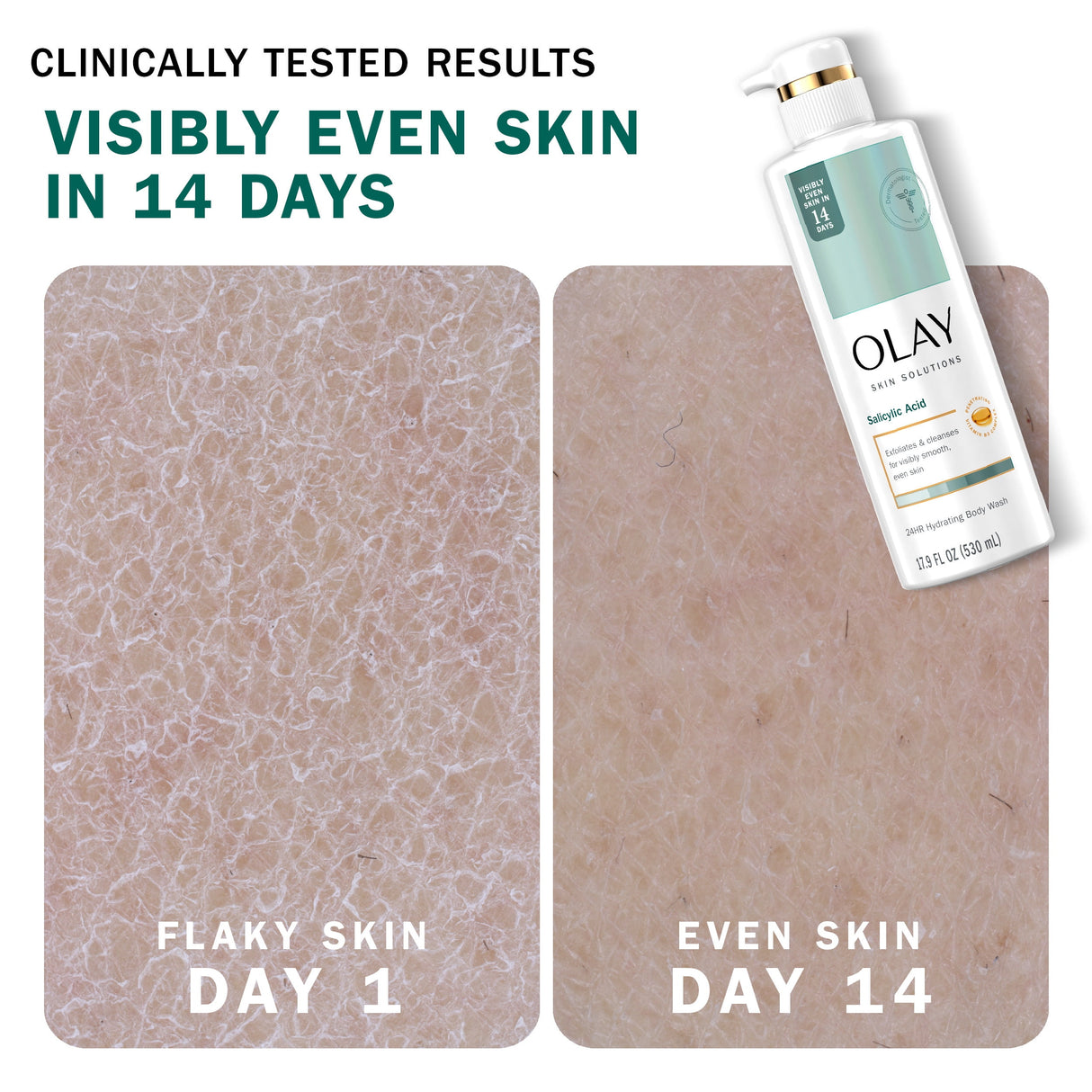 Olay Salicylic Acid Body Wash - Kenya