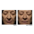 RETINOL CORREXION® Deep Wrinkle Night Cream image 5