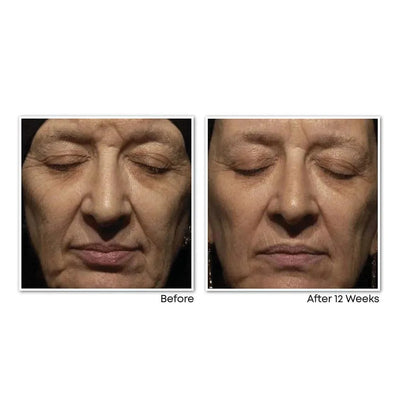 RETINOL CORREXION® Deep Wrinkle Night Cream - view 5