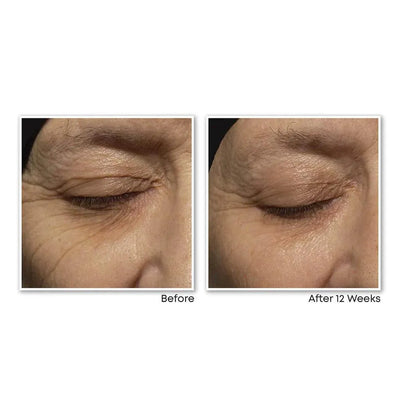 RETINOL CORREXION® Deep Wrinkle Night Cream - view 6