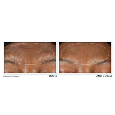 RETINOL CORREXION® Deep Wrinkle Serum Cleanser - view 4