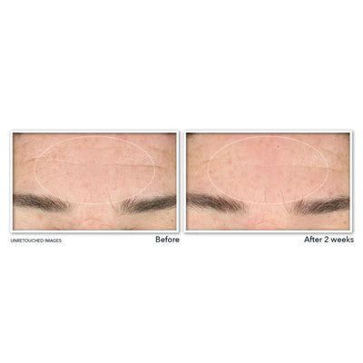 RETINOL CORREXION® Deep Wrinkle Serum Cleanser - view 5