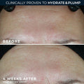 RoC Hydration moisturizer, SPF 30 image 5