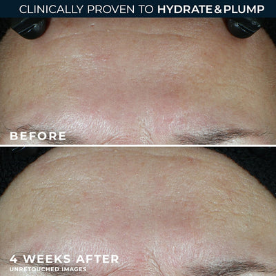 RoC Hydration moisturizer, SPF 30 - view 5