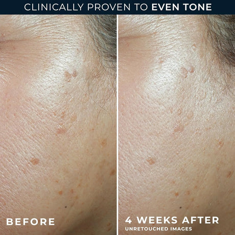 RoC Multi Correxion Even Tone + Lift Moisturizer SPF 30 - Kenya