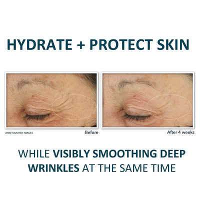 RoC Retinol Correxion Deep Wrinkle Daily Face Moisturizer with Sunscreen SPF 30 - view 3