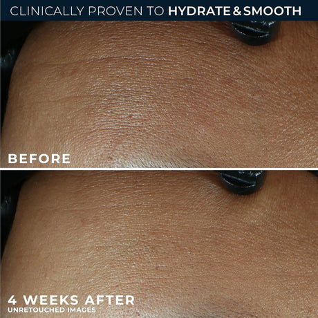 RoC Retinol Correxion Max Daily Hydration Cream - Kenya