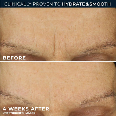 RoC Retinol Correxion Max Daily Hydration Cream - view 5