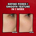 Thayers 2% AHA Exfoliating Toner with Glycolic Acid image 4