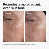 The Ordinary Glycolic Acid 7% Exfoliating Toner - Kenya