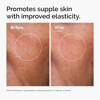 The Ordinary Hyaluronic Acid 2% + B5 - view 4