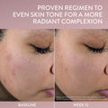 Cetaphil Healthy Radiance Gentle Exfoliating Cleanser image 7