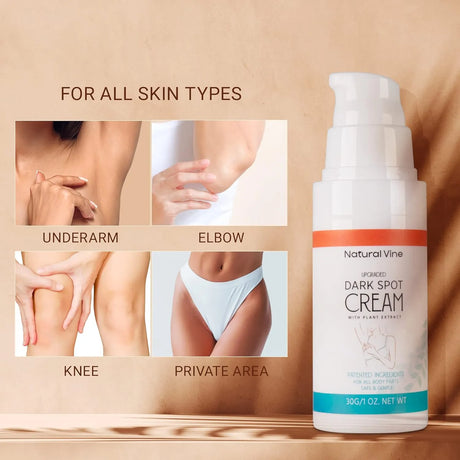 Natural Vine Dark Spot Remover for Body - Kenya