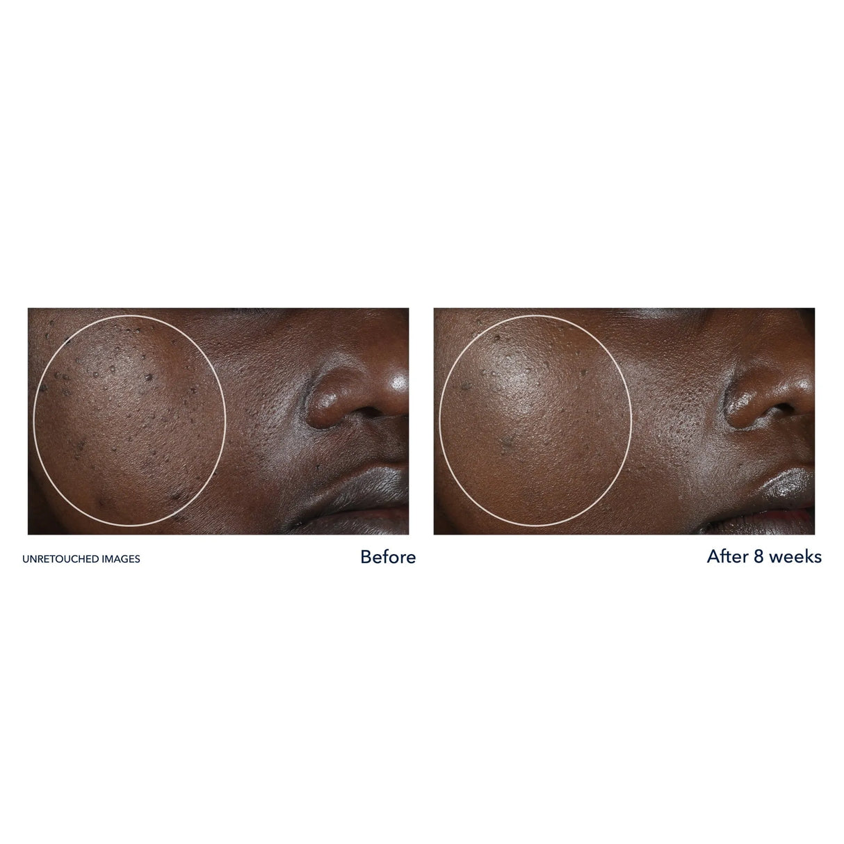 Roc Multi Correxion Even Tone + Lift Hexyl-R Night Cream - Kenya