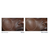 Roc Multi Correxion Even Tone + Lift Hexyl-R Night Cream - Kenya