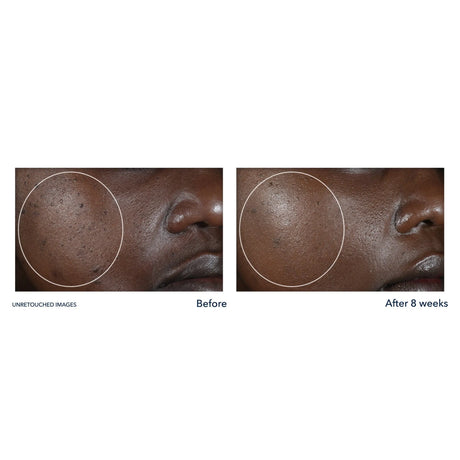 Roc Multi Correxion Even Tone + Lift Hexyl-R Night Cream - Kenya