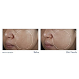 Roc Multi Correxion Even Tone + Lift Hexyl-R Night Cream - Kenya